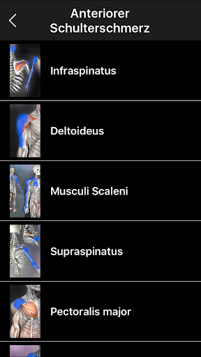 Muskel Triggerpunkte Anatomie Screenshot