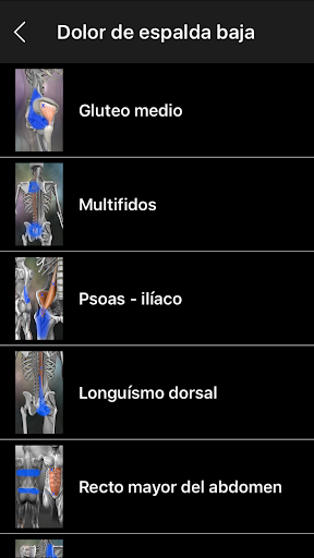 Captura de pantalla de Puntos Musculares Anatomia