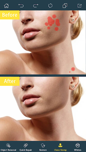Captura de pantalla de Photo Retouch-Borrar Objetos