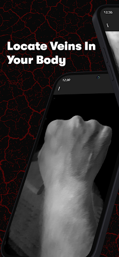 X-Vein screenshot