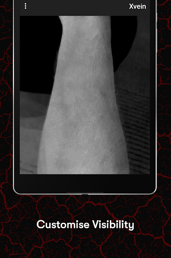 X-Vein screenshot