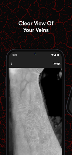 X-Vein screenshot