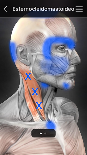 Captura de pantalla de Puntos Musculares Anatomia