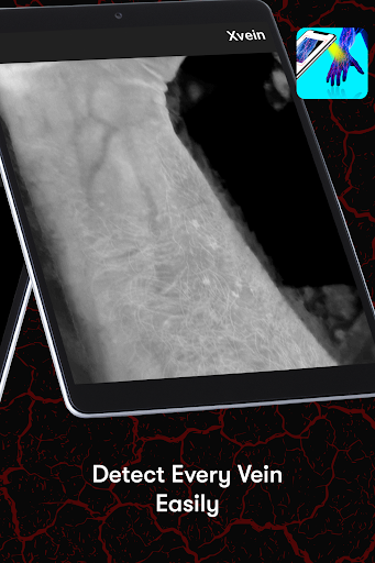X-Vein screenshot