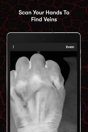 X-Vein screenshot