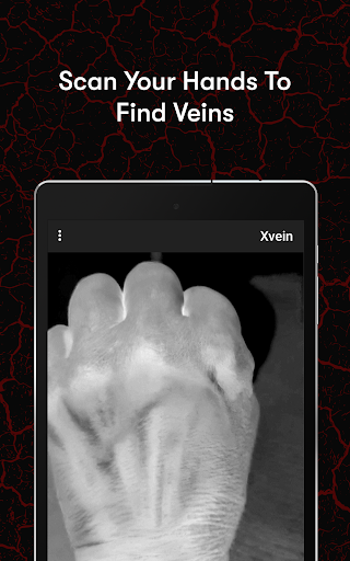 X-Vein screenshot